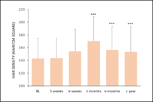 PRP Therapy in Hair Lose 1 .jpg